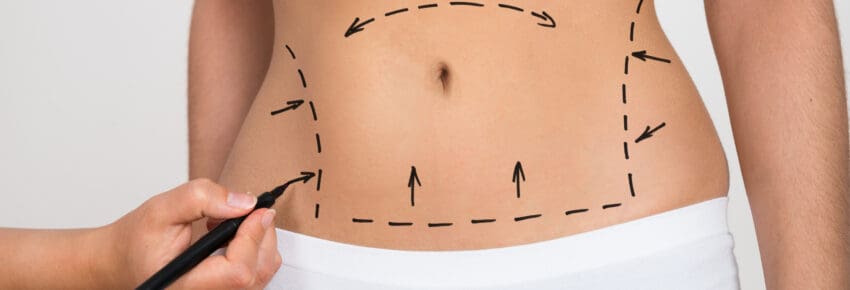 Temecula Body Contouring | Plastic Surgery